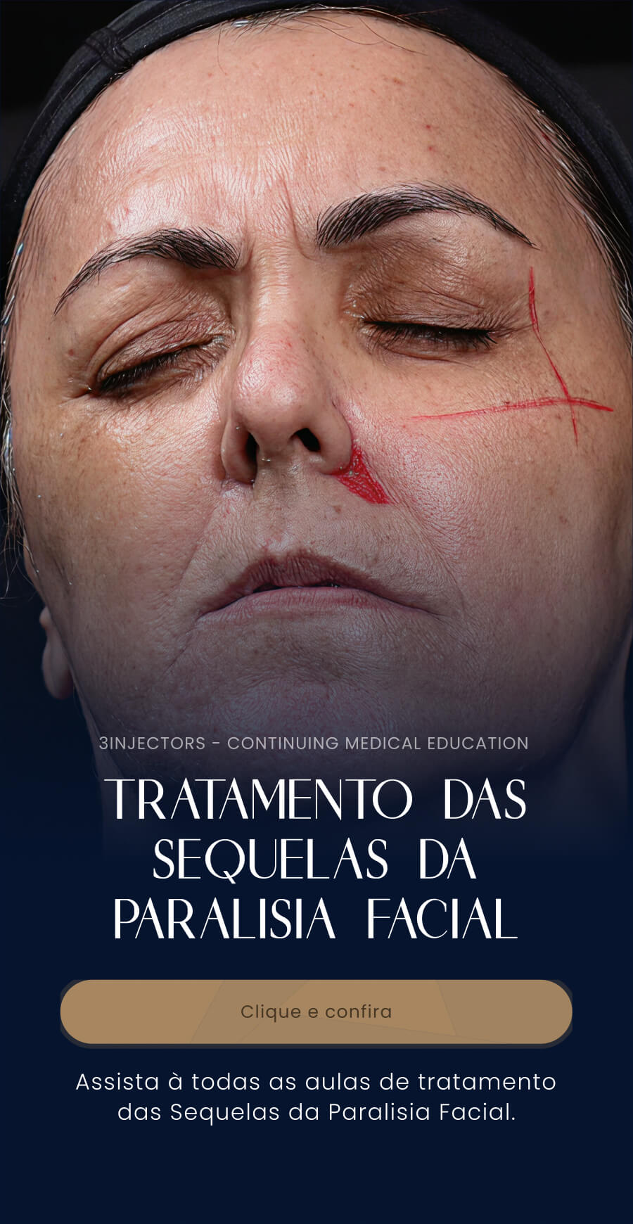 banner_bruna_tratamento_paralisia